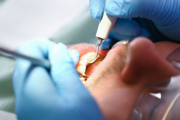 Best Knocked-Out Tooth Emergency  in Brookridge, FL